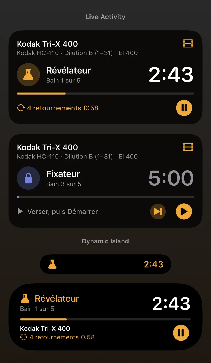 Activité en direct et Dynamic Island