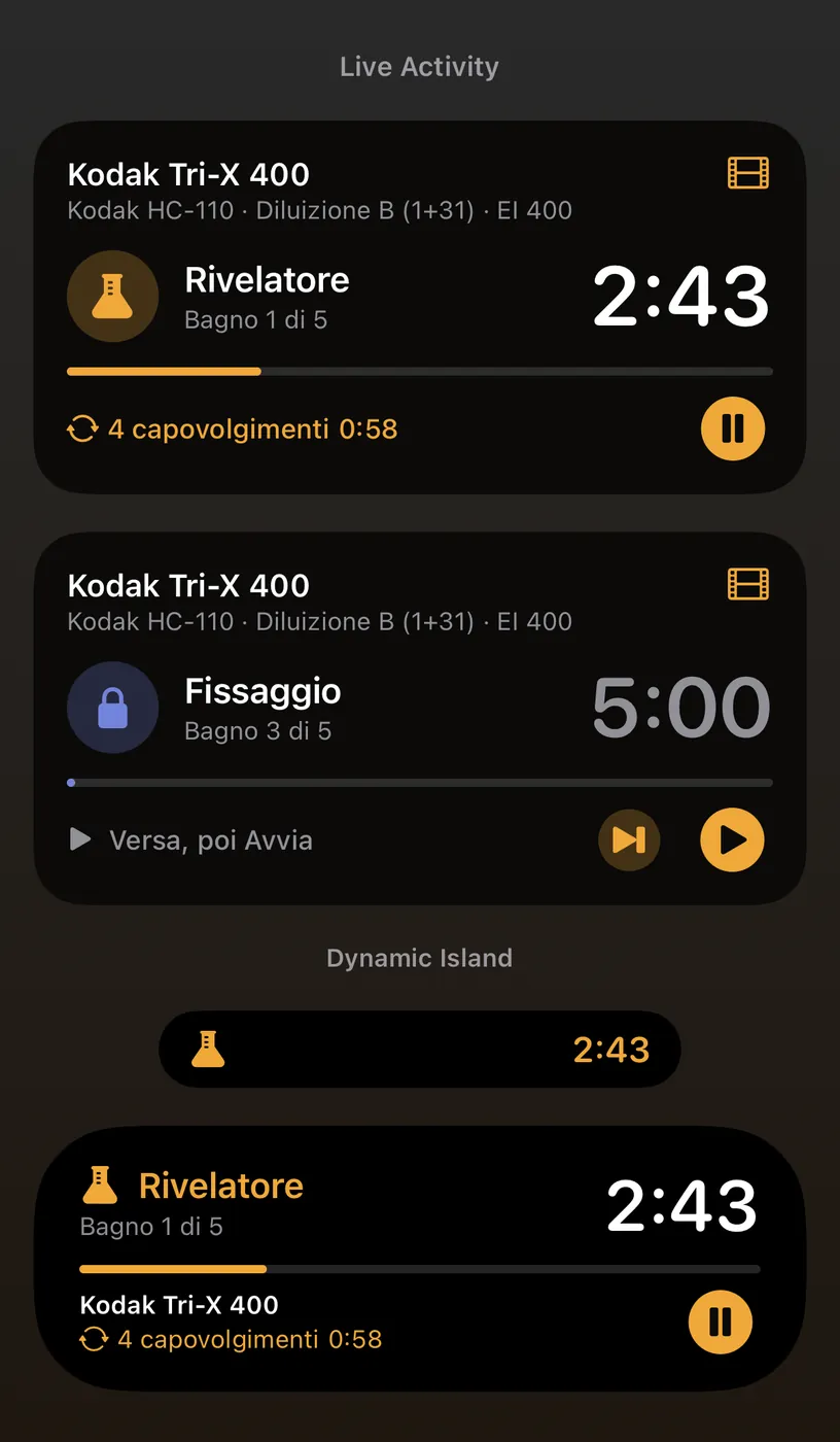 Live Activity e Dynamic Island